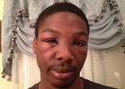 Police Brutality and Pot on Long Island